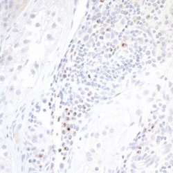 B7-2/CD86 Antibody (BLR030F), Novus Biologicals 100 &mu;L | Buy Online | Novus Biologicals | Fisher Scientific