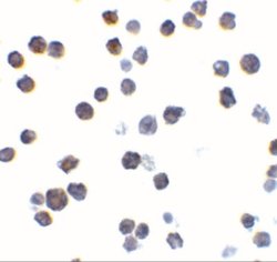 BAK Antibody, Novus Biologicals 0.025mg:Antibodies, Polyclonal