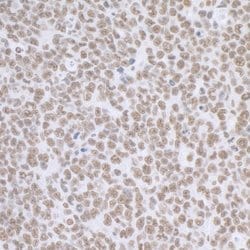 BCAS2 Antibody, Novus Biologicals 100 &mu;L | Buy Online | Novus Biologicals | Fisher Scientific