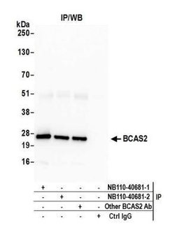 BCAS2 Antibody, Novus Biologicals 100 &mu;L | Buy Online | Novus Biologicals | Fisher Scientific