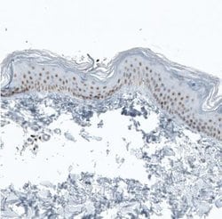 BCL11B Antibody (CL6426), Novus Biologicals:Antibodies:Primary Antibodies