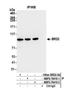 BRD2 Antibody (BL-167-2A2), Novus Biologicals 100 &mu;L | Buy Online | Novus Biologicals | Fisher Scientific
