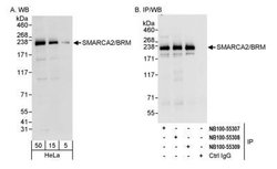 BRM Antibody, Novus Biologicals 0.1 mL | Buy Online | Novus Biologicals | Fisher Scientific
