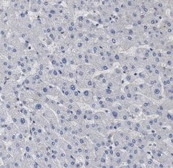 BTN2A1 Antibody, Novus Biologicals 0.1mL; Unlabeled:Antibodies, Polyclonal