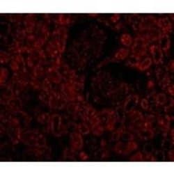 Bcl-2 Antibody, Novus Biologicals 0.025mg:Antibodies, Polyclonal