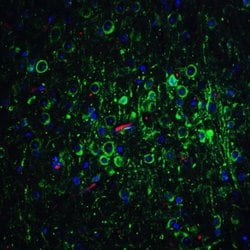 Bcl-2 Antibody, Novus Biologicals 0.025mg:Antibodies, Polyclonal