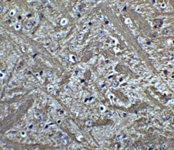 Bcl-2 Antibody, Novus Biologicals 0.025mg:Antibodies, Polyclonal