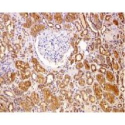 Bcl-2 Antibody, Novus Biologicals 0.025mg:Antibodies, Polyclonal