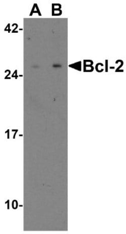 Bcl-2 Antibody, Novus Biologicals 0.025mg:Antibodies, Polyclonal