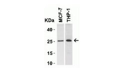Bcl-2 Antibody, Novus Biologicals 0.025mg:Antibodies, Polyclonal