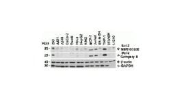 Bcl-2 Antibody, Novus Biologicals 0.025mg:Antibodies, Polyclonal