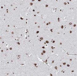 C22orf9 Antibody, Novus Biologicals 0.1mL; Unlabeled:Antibodies, Polyclonal