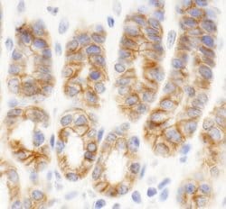 C2CD5 Antibody, Novus Biologicals 0.1mL; Unlabeled:Antibodies, Polyclonal