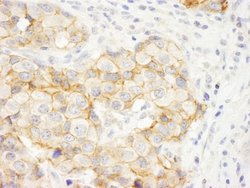 C2CD5 Antibody, Novus Biologicals 0.1mL; Unlabeled:Antibodies, Polyclonal