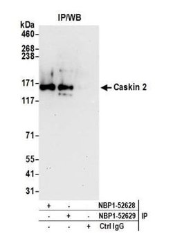 CASKIN2 Antibody, Novus Biologicals 0.1mg; Unlabeled:Antibodies, Polyclonal