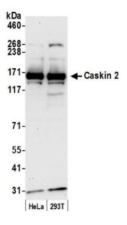 CASKIN2 Antibody, Novus Biologicals 0.1mg; Unlabeled:Antibodies, Polyclonal