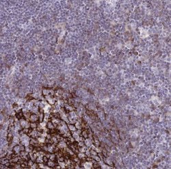 CD21 Antibody, Novus Biologicals 0.1mL; Unlabeled:Antibodies, Polyclonal