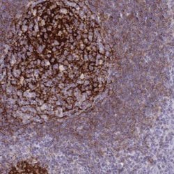CD21 Antibody, Novus Biologicals 0.1mL; Unlabeled:Antibodies, Polyclonal