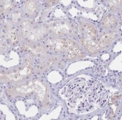 CD21 Antibody, Novus Biologicals 0.1mL; Unlabeled:Antibodies, Polyclonal
