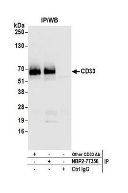 CD4 Antibody (BL-155-1C11), Novus Biologicals 100 &mu;L | Buy Online | Novus Biologicals | Fisher Scientific