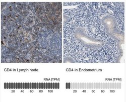 CD4 Antibody, Novus Biologicals 0.1mL; Unlabeled:Antibodies, Polyclonal