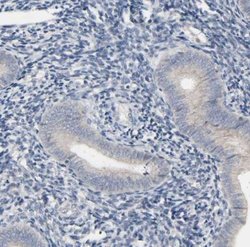 CD4 Antibody, Novus Biologicals 0.1mL; Unlabeled:Antibodies, Polyclonal