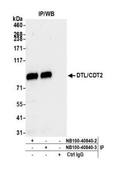 CDT2 Antibody, Novus Biologicals 0.1mL; Unlabeled:Antibodies, Polyclonal