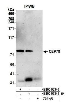 CEP78 Antibody, Novus Biologicals 0.1 mL | Buy Online | Novus Biologicals | Fisher Scientific