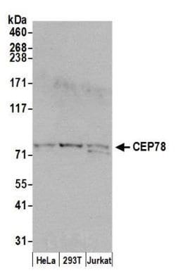 CEP78 Antibody, Novus Biologicals 0.1 mL | Buy Online | Novus Biologicals | Fisher Scientific