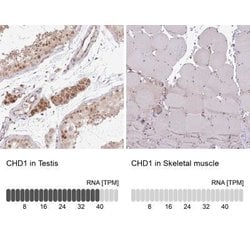 CHD1 Antibody, Novus Biologicals 0.1mL; Unlabeled:Antibodies, Polyclonal