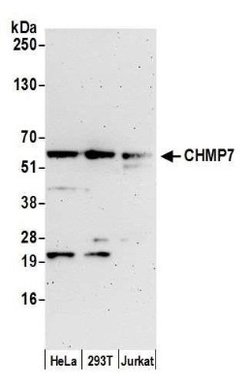 ARMT1 Rabbit anti-Human, Polyclonal, Novus Biologicals 0.1mL:Antibodies,