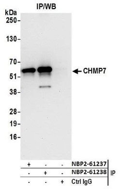 ARMT1 Rabbit anti-Human, Polyclonal, Novus Biologicals 0.1mL:Antibodies,