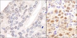 COP9 signalosome complex subunit 2 Antibody, Novus Biologicals 0.1mg; Unlabeled:Antibodies,