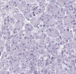 CRYBB2 Antibody, Novus Biologicals:Antibodies:Primary Antibodies