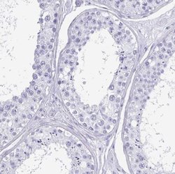 CRYBB2 Antibody, Novus Biologicals:Antibodies:Primary Antibodies