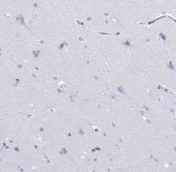 CRYBB2 Antibody, Novus Biologicals:Antibodies:Primary Antibodies