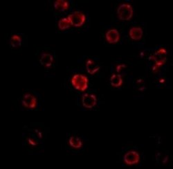 CXCR4 Antibody - BSA Free, Novus Biologicals 0.025mg:Antibodies, Polyclonal