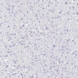 CXorf67 Antibody, Novus Biologicals 25 &mu;L; Unlabeled:Antibodies, Polyclonal