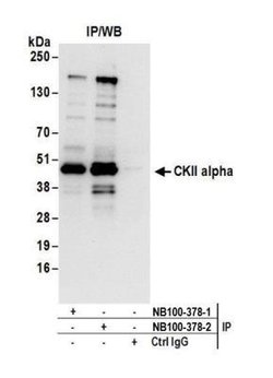 Casein Kinase 2 alpha Antibody, Novus Biologicals 0.1mg; Unlabeled:Antibodies,