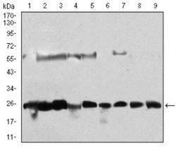 Casein Kinase 2 beta Antibody (2F12F3) - BSA Free, Novus Biologicals 0.1mg;