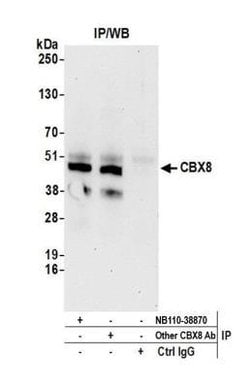 Cbx8 Antibody, Novus Biologicals 100 &mu;L | Buy Online | Novus Biologicals | Fisher Scientific