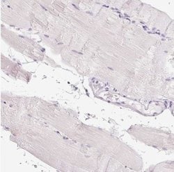 Collagen VII Antibody, Novus Biologicals:Antibodies:Primary Antibodies