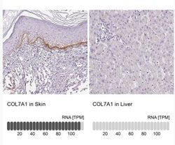 Collagen VII Antibody, Novus Biologicals:Antibodies:Primary Antibodies