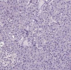 Collagen VII Antibody, Novus Biologicals:Antibodies:Primary Antibodies