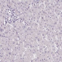 Collagen VII Antibody, Novus Biologicals:Antibodies:Primary Antibodies