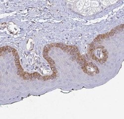 Collagen XVII Antibody, Novus Biologicals 25 &mu;L, Unconjugated:Antibodies,