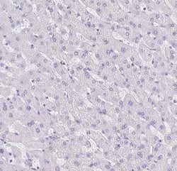 Collagen XVII Antibody, Novus Biologicals 25 &mu;L, Unconjugated:Antibodies,