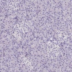 Collagen XVII Antibody, Novus Biologicals:Antibodies:Primary Antibodies