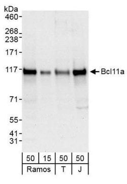 Ctip1 Antibody, Novus Biologicals 0.1mL; Unlabeled:Antibodies, Polyclonal