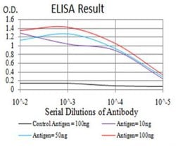 Cytokeratin 5 Antibody (2C8E4) - BSA Free, Novus Biologicals:Antibodies:Primary